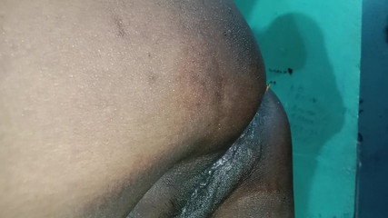 It Is in a Lot of Hurt