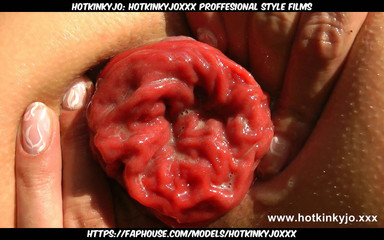 When the Dreams Come True Anal Fisting & Prolapse by Hotkinkyjo