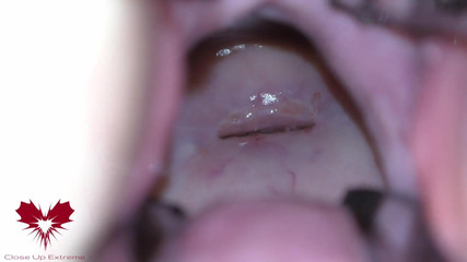 The Mistress' Cunt Is Opened with a Hole Expander so That You Can Study Her Cervix