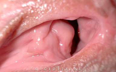 When You Work as a Gynecologist and Your Client Cums From Excitement!