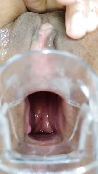 Anal expansion with speculum