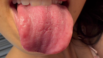 Come on Top of Me and Smell My Breath