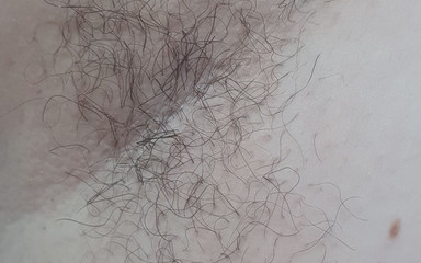 Hairy Armpit Show