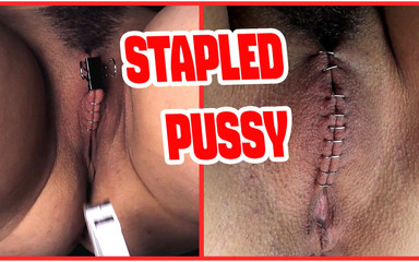 Sadistic Doctor Closes and Staples His Patient's Pussy