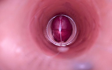 Female Insemination - Internal Camera Captures Deep Male Ejaculation